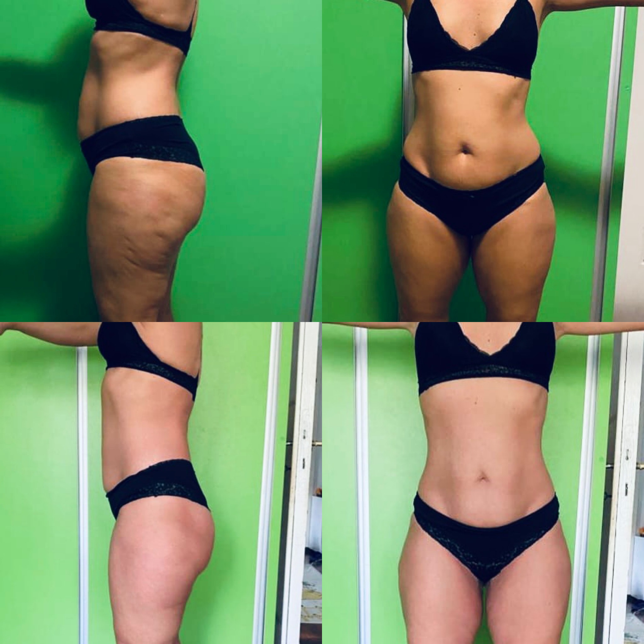 Transformare Nutritivo