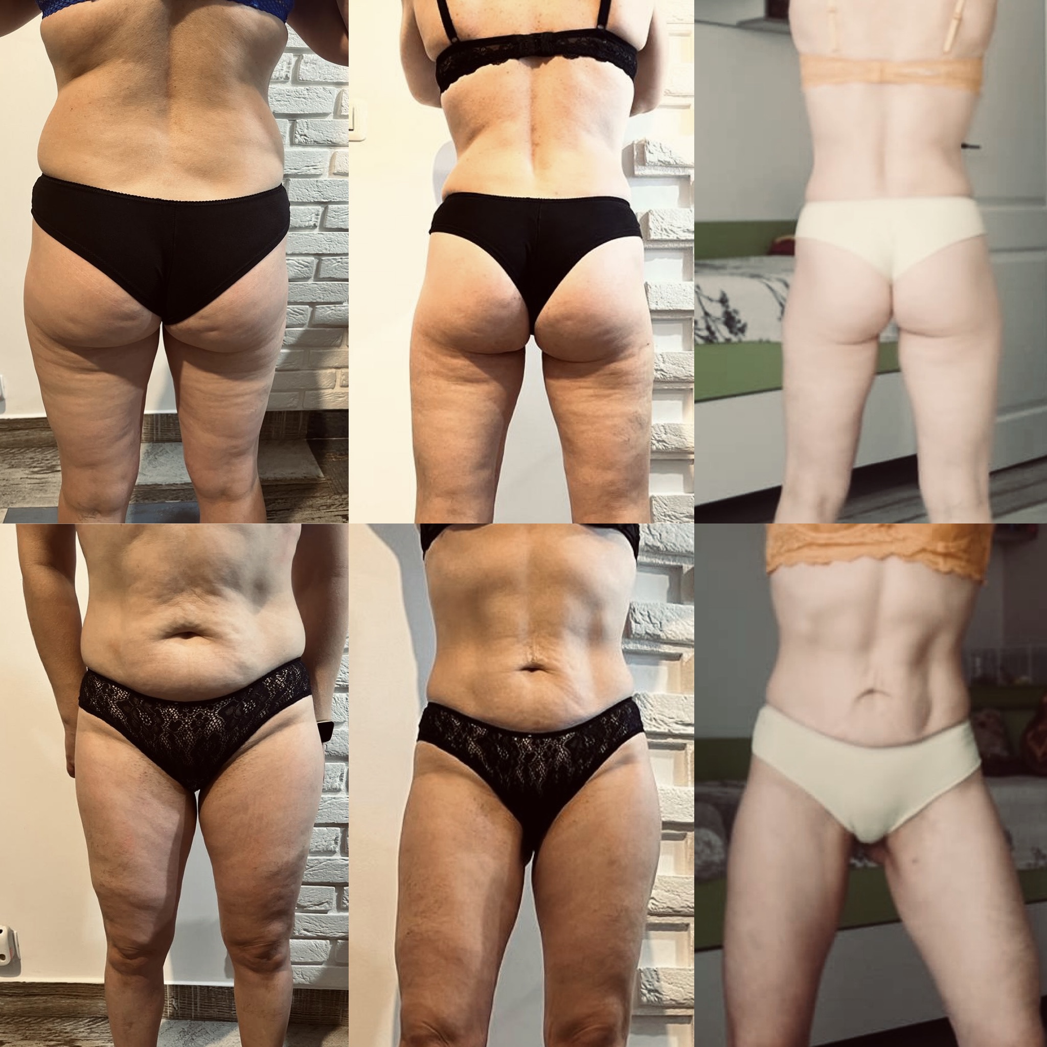 Transformare Nutritivo