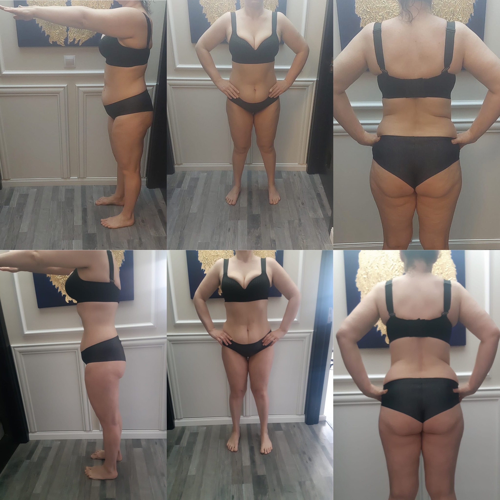 Transformare Nutritivo